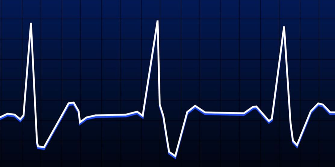 Apa Itu Resting Heart Rate? Kenali Standard yang Berbeda pada Setiap Orang