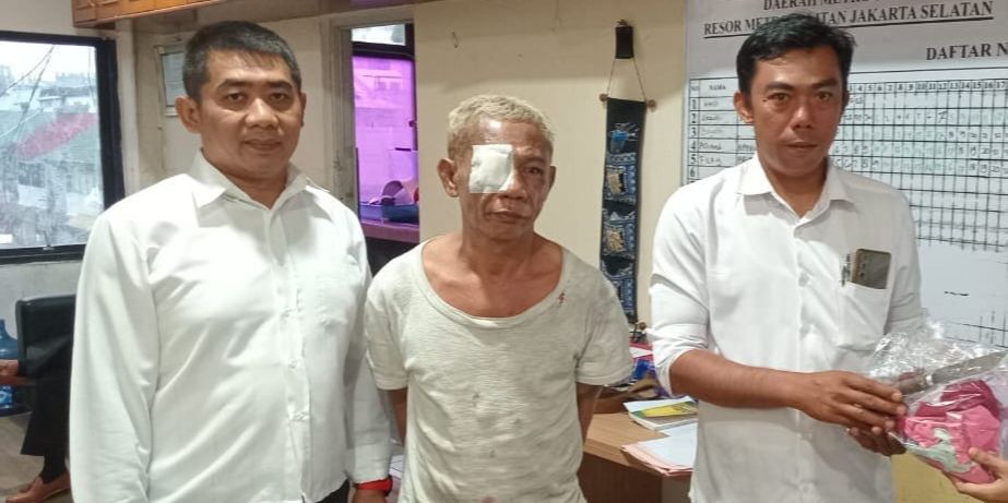 Berkaos Lusuh dan Mata Diperban, Begini Tampang Penyandera Bocah di Pospol Pejaten Village Jaksel