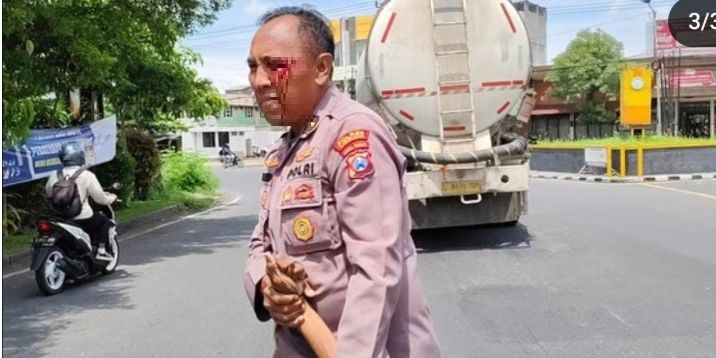 Kondisi Ipda Purnomo Polisi Baik Dipukul ODGJ Hingga Berdarah-darah, Didorong Terbaring Masuk IGD RS