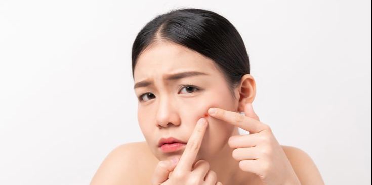 Punya Kulit Berjerawat? Ini Urutan Skincare Malam yang Paling Efektif untuk Hasil Maksimal dan Jerawat Langsung Kempes