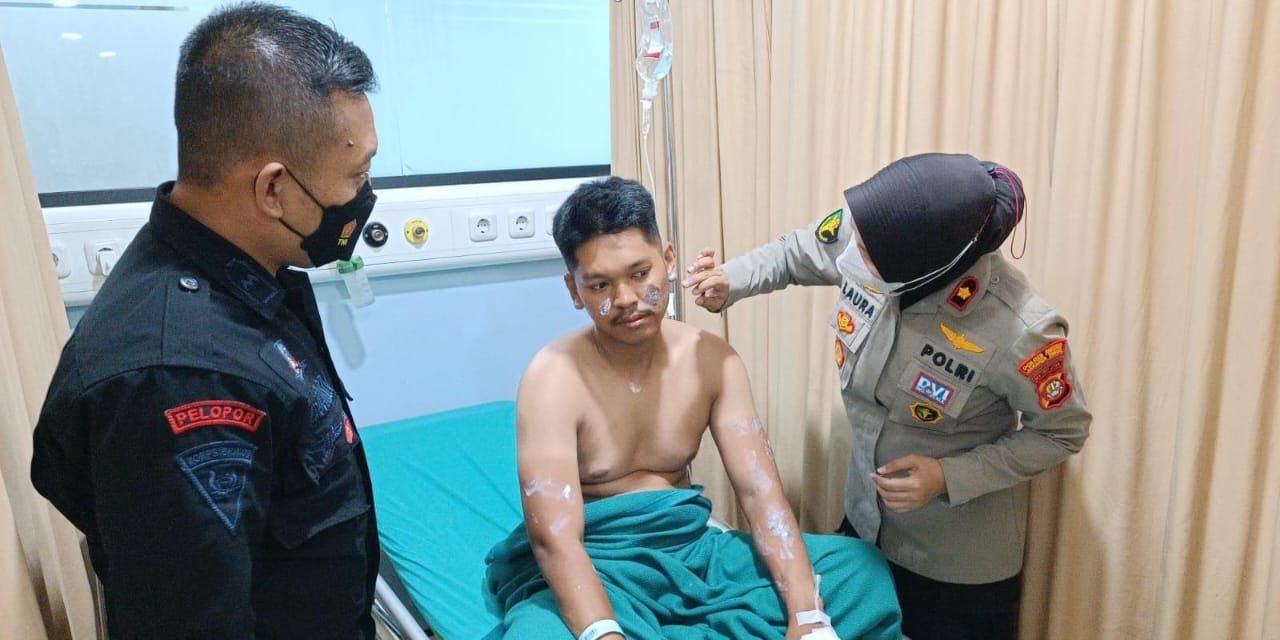 Bentuk Timsus, Polda Metro Wanti-Wanti Penyiram Air Keras ke Brimob Menyerahkan Diri