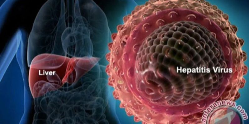 Kemenkes: Prevalensi Hepatitis B dan C Turun dalam Beberapa Tahun Terakhir