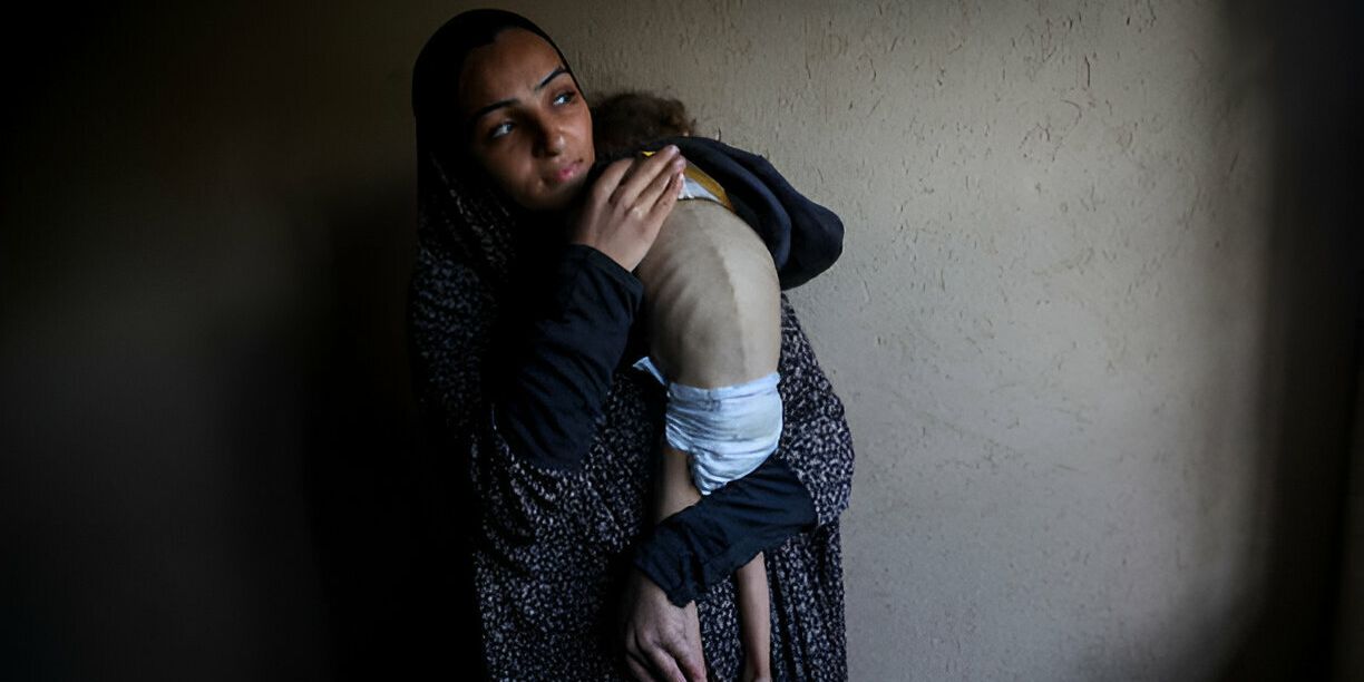 Anak-anak Gaza Sekarat karena Kedinginan dan Kurang Gizi, Israel Blokir Vaksin dan Bantuan