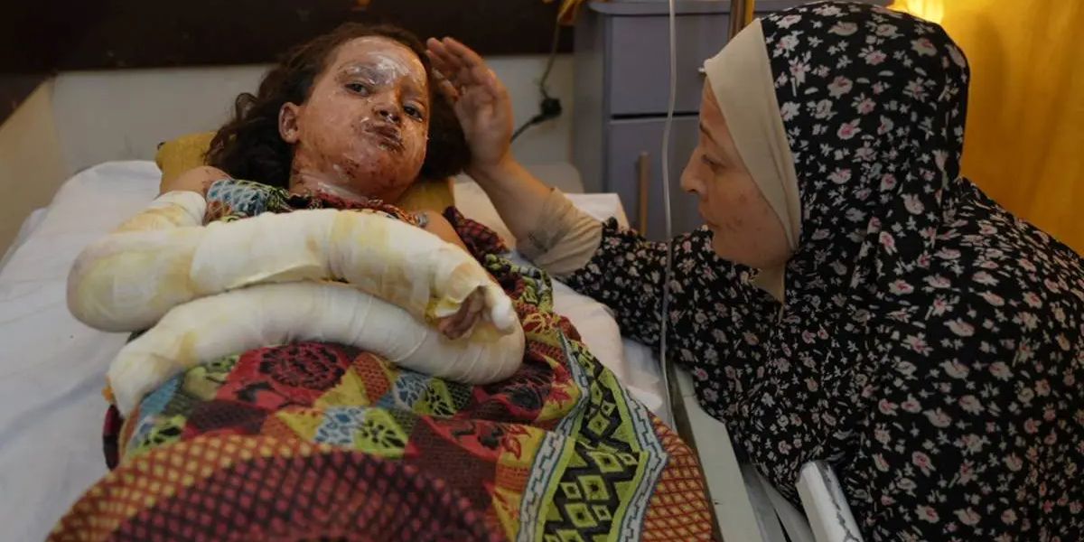 70 Persen Korban Luka Bakar di Gaza adalah Anak-Anak, Sebagian Besar di Bawah Usia 5 Tahun