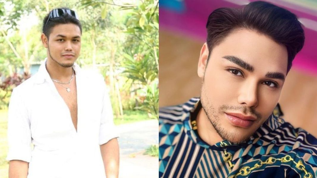 15 Transformasi Artis yang Lakukan Veneer Gigi, Hasilnya Semakin Putih dan Bersinar