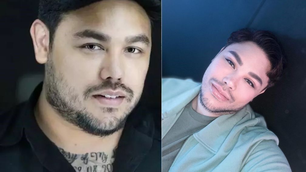 10 Potret Artis Sebelum-Sesudah Filler Bibir, dari Ivan Gunawan sampai Momo Eks Geisha