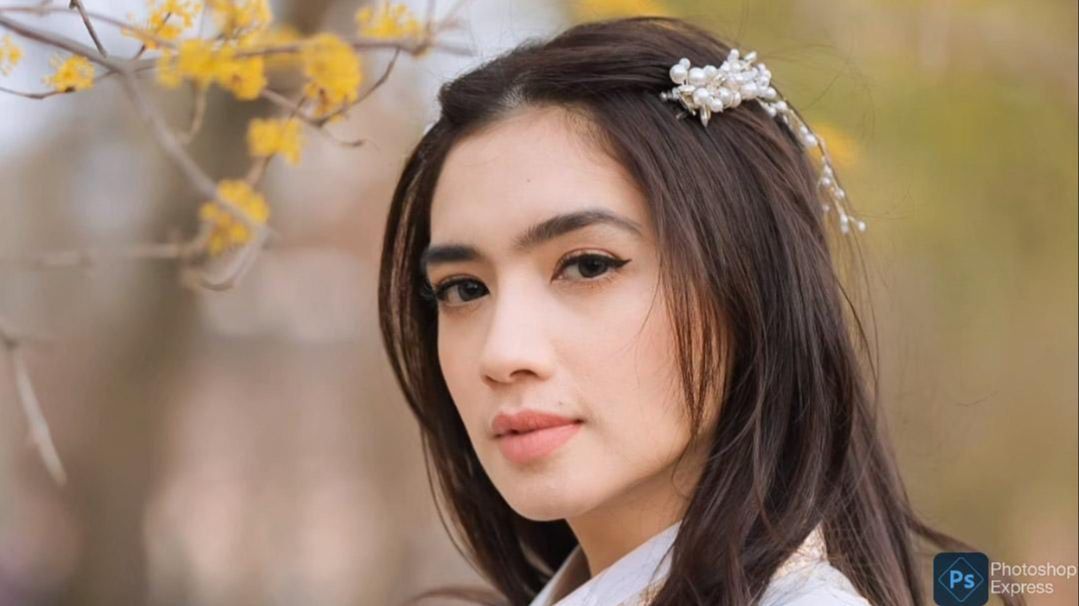 Potret Angel Karamoy Jalani Oplas di Korea Selatan, Netizen 'Udah Cantik Spek Bidadari Mau Jadi Gimana'