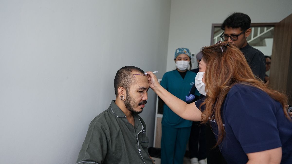 Mengenal Teknik DHI, Mengatasi Kebotakan dengan Tanam Rambut dengan Cara Modern