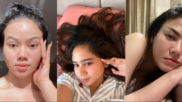 10 Potret Artis Tampil Percaya Diri Pamerkan Bare Face, Tetap Menawan Meski Wajah Penuh Jerawatan