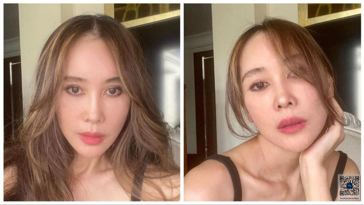 Potret Terbaru Ina Istri Jeremy Thomas Lakukan Oplas Facelift di Korea Selatan,  Hasilnya Bikin Melongo!