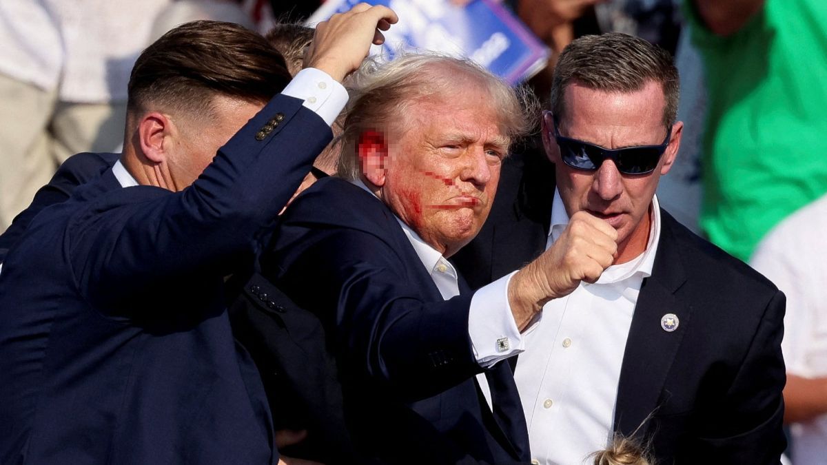 FOTO: Inilah Luka Donald Trump yang Tertembak saat Kampanye Pilpres Amerika Serikat