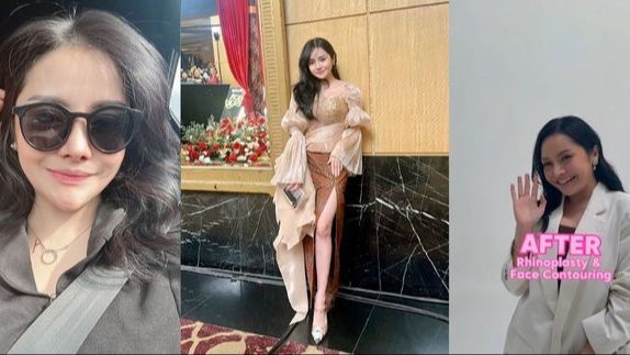 Potret Terbaru Mawar AFI yang Makin Cantik Usai Oplas di Korea Selatan, Hasilnya Dinilai Berhasil