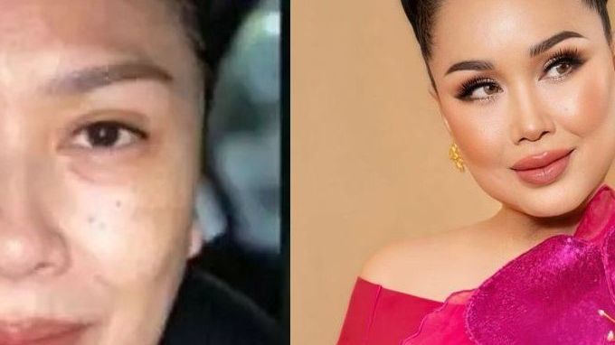 Kembali Muda Bak ABG, 9 Potret Transformasi Artis Indonesia Sebelum & Sesudah Face Lifting