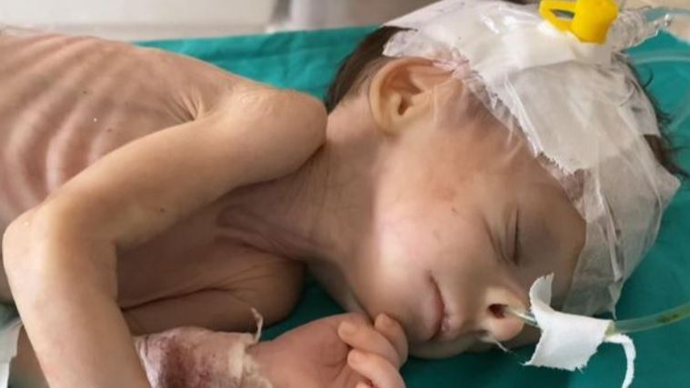 Ibu Kurang Gizi Tak Ada Makanan dan ASI, Bayi Baru Lahir di Gaza Sulit Bertahan Hidup