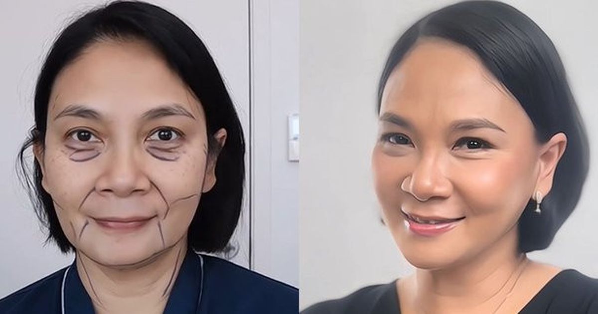 Potret Wajah Dian Nitami Sebulan Pasca Face Lifting: Kulit Kencang dan Hasil Natural