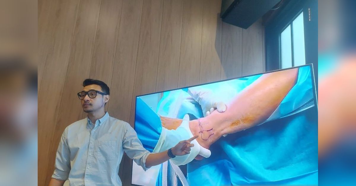 Sepatu Tepat Cegah Cidera Kaki: Saran Dokter Spesialis