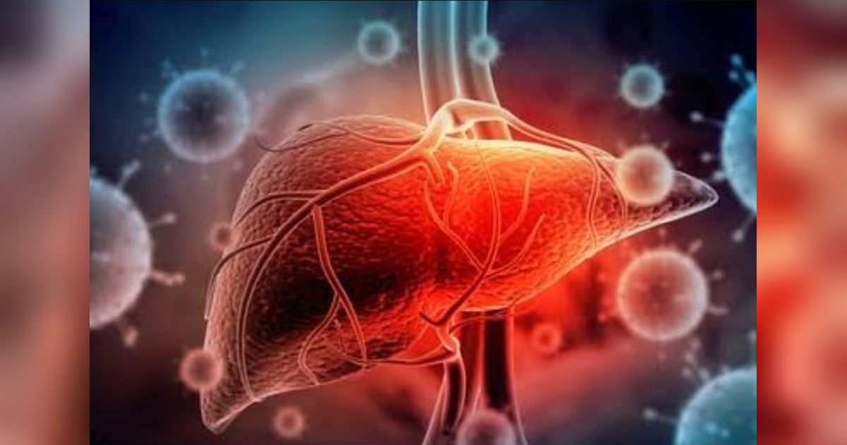 Waspada Hepatitis! Kenali Penyebab, Pencegahan, dan Pengobatannya