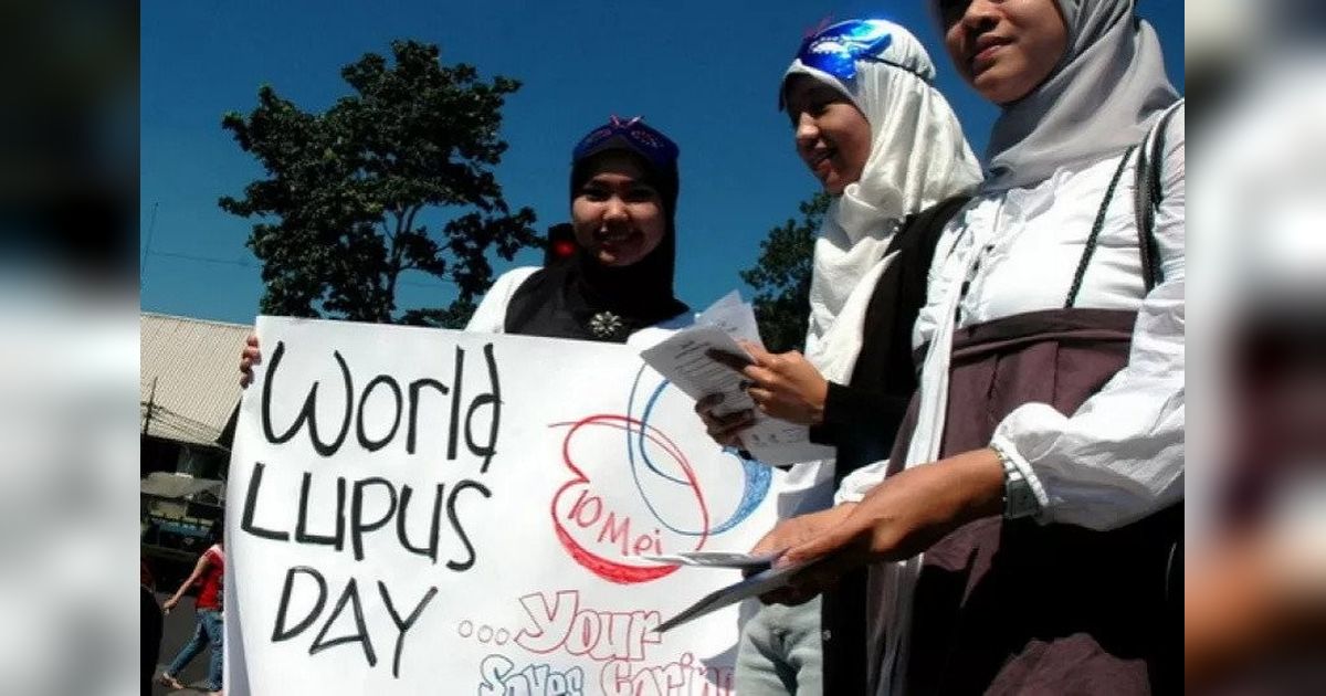 Edukasi Gencar untuk Cegah Komplikasi Lupus: Dokter Dorong Deteksi Dini