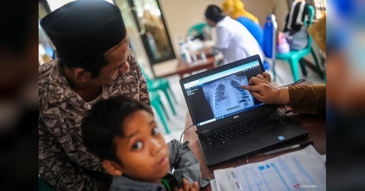 Butuh Vaksin TB Baru? Pakar Sebut BCG Sudah Usang!