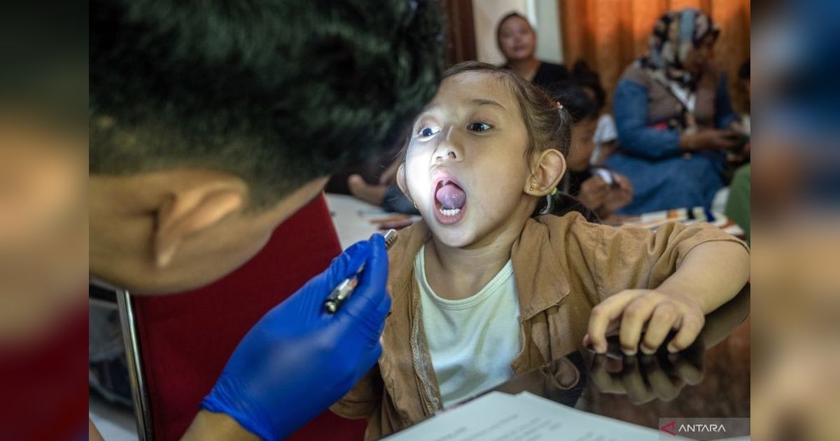 Bibir Sumbing? Bedah Plastik Tawarkan Solusi untuk Pertumbuhan Normal Anak