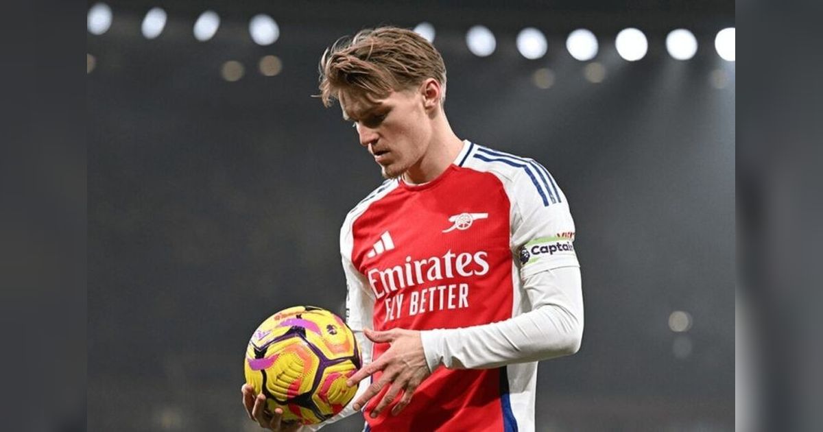 Fakta! Cedera Martin Odegaard Membuatnya Jadi Pemain Keempat Arsenal yang Absen Akibat Masalah Lutut, Arteta Ungkap Kondisinya