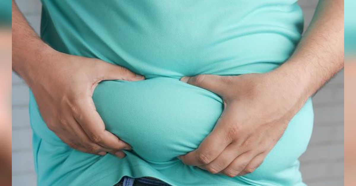 Waspada! Obesitas Sejak Muda Bisa Picu Risiko Kematian Dini hingga 70 Persen