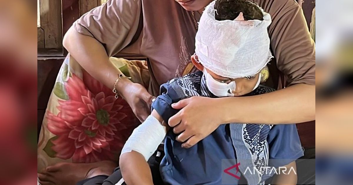 Dinkes Cianjur Catat 32 Kasus Gigitan Hewan Liar Sepanjang Awal 2026, Waspada Serangan Monyet