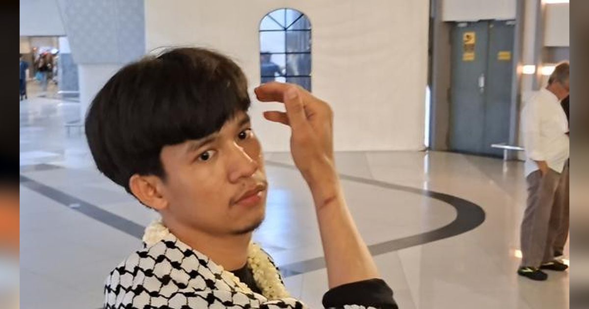 Bekas Luka Borgol di Tangan Andre Ungkap Kejinya Perlakuan Israel terhadap Relawan Peserta Global Sumud Flotilla