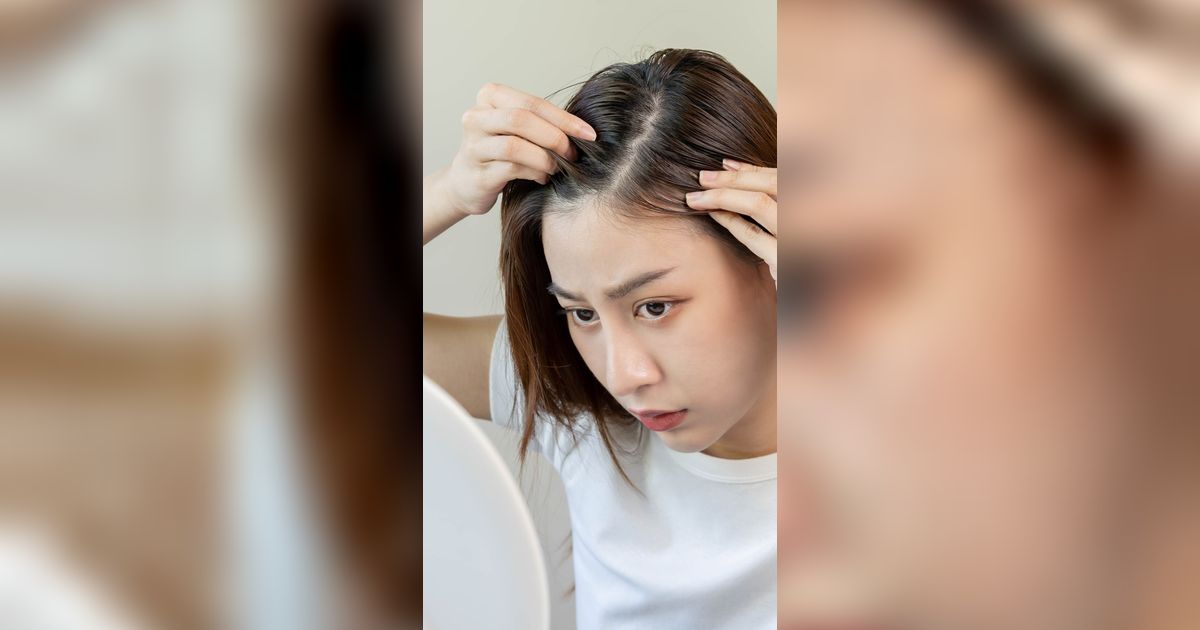 Sulit Dapatkan Rambut Sehat? Mungkin, Kamu Sering Lakukan Kesalahan Ini