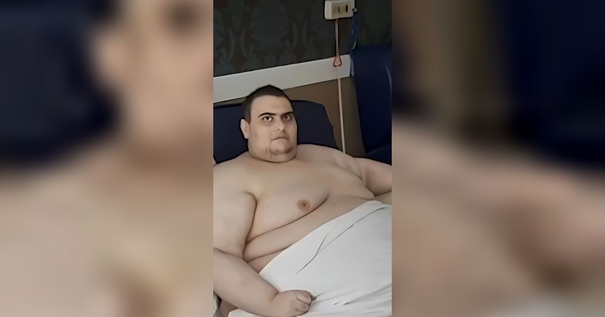 Hobi Makan Bikin Pemuda Ini Obesitas dengan Bobot Hampir 300 Kg, Kini Merengek Minta Disuntik Obat Ajaib Penurun Berat Badan
