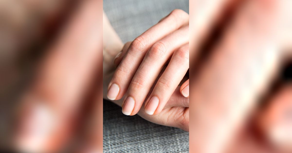 Bikin Perih, 5 Hal Penyebab Kutikula Mengelupas