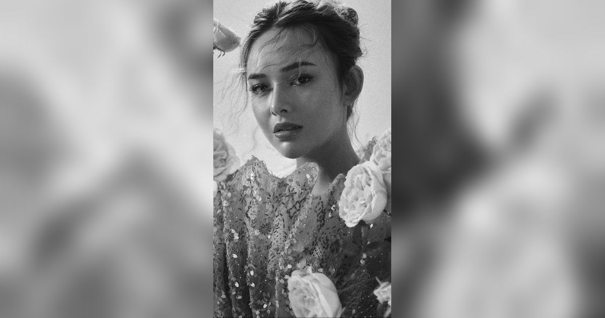 Amanda Manopo Hampir Meninggal Gara-Gara Idap Epilepsi