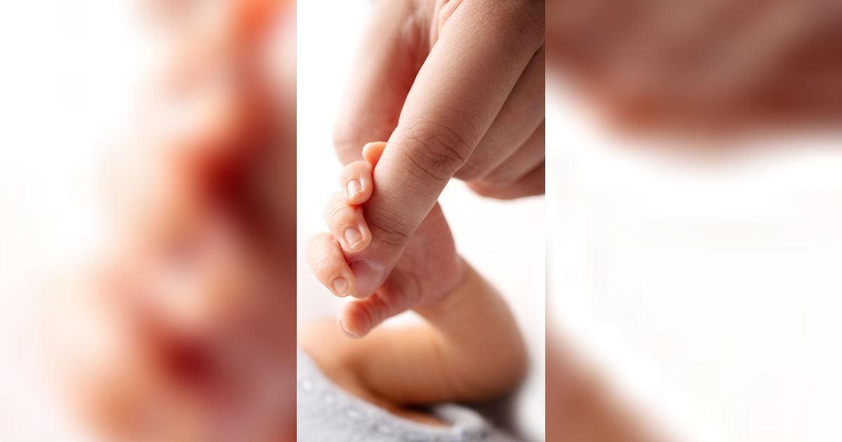 Membusung Dikira Tumor, Bayi 5 Bulan di Sumbar `Hamil` Diduga Makan Kembarannya Saat dalam Rahim