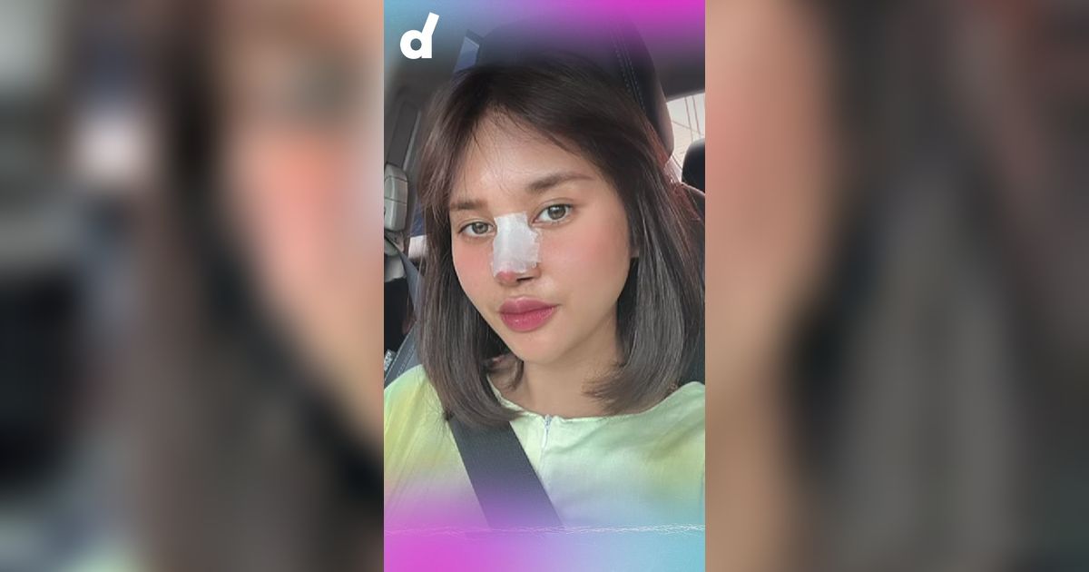 Capek Di-Bully, Permesta Dhyaz, Anak Food Vlogger Farida Nurhan, Oplas Hidung Lagi
