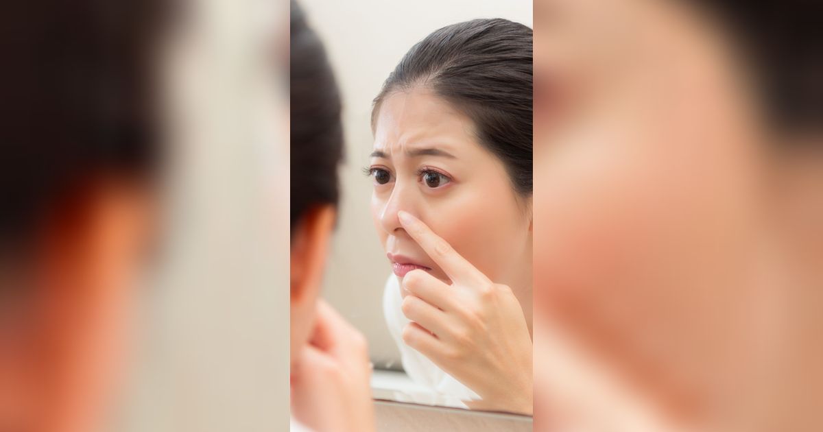 Bintik Putih di Hidung Belum Tentu Komedo,  Bisa Jadi Sebaceous Filamen