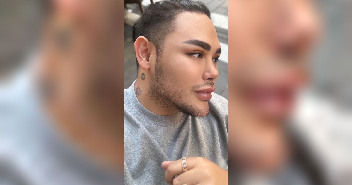 Penampilan Terbaru Ivan Gunawan Usai Permak Hidung, Disebut Mirip Nikita Mirzani