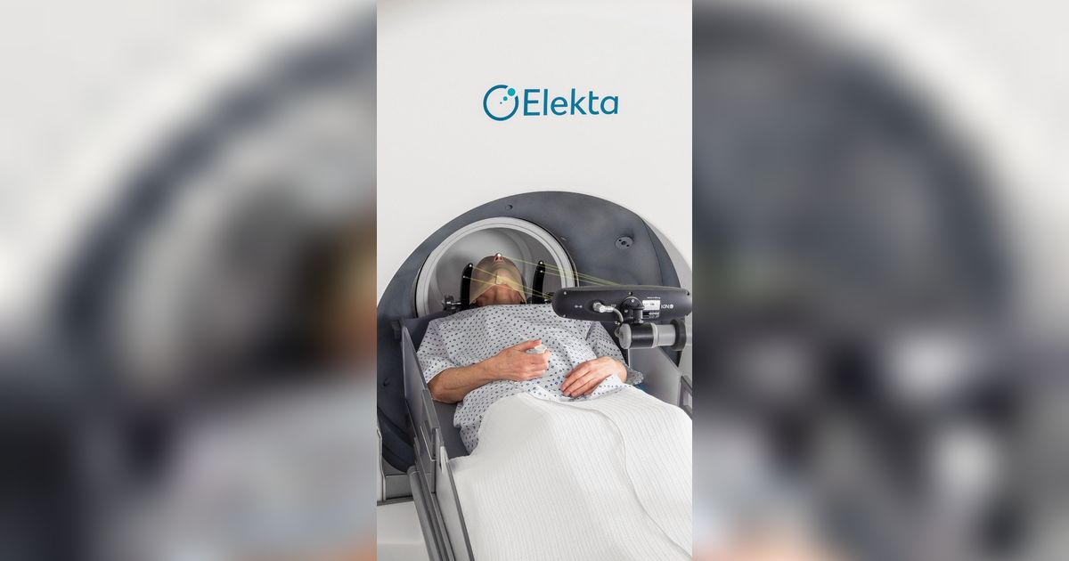 Mengenal Gamma Knife Surgery, Pengobatan Tumor Otak Tanpa Bedah