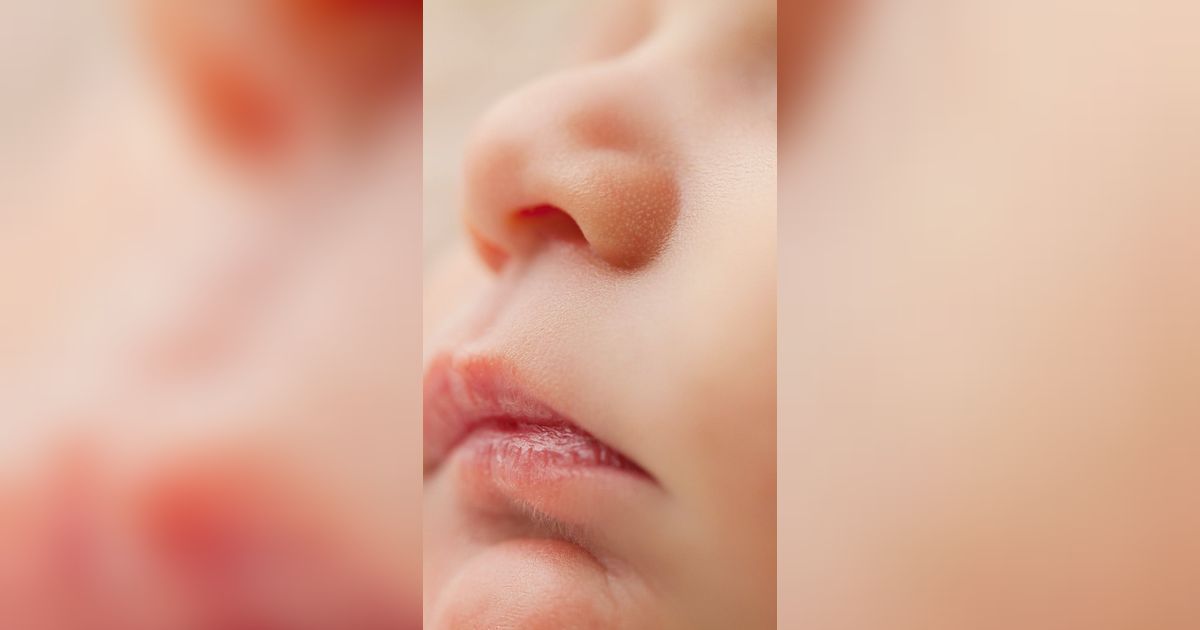 Penyebab Bibir Kering pada Anak, Begini Cara Mengatasinya