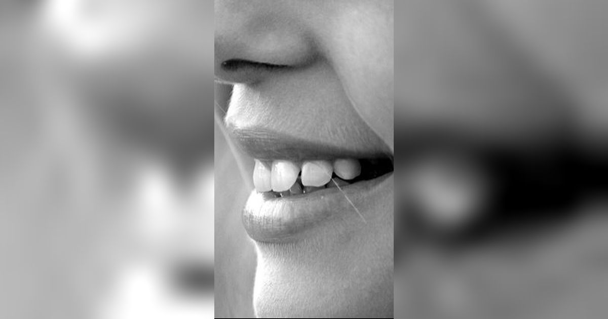 Cara Mengurangi Penumpukan Karang Gigi, Rutin Menyikat hingga Berhenti Merokok
