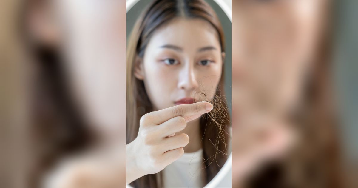 4 Langkah Lawan Rambut Rontok untuk Pria dan Wanita, Jangan Dibiarkan Sampai Botak