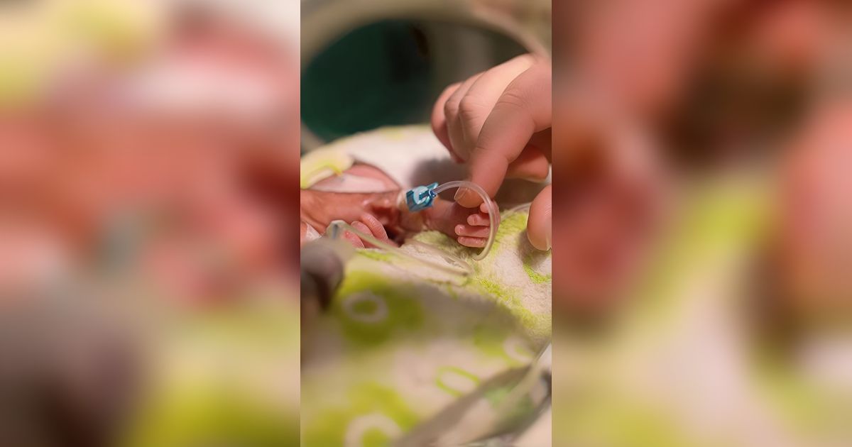 Potret Haru 28 Bayi Prematur Berhasil Dievakuasi dari Gaza ke Mesir, Kondisinya Memprihatinkan