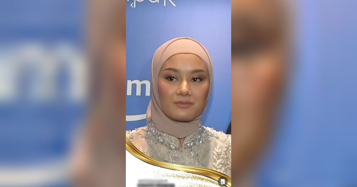 10 Potret Artis Korban Kamera `Jahat` Wartawan, Terbaru Dinda Hauw, Wajah Aslinya Jadi Omongan!