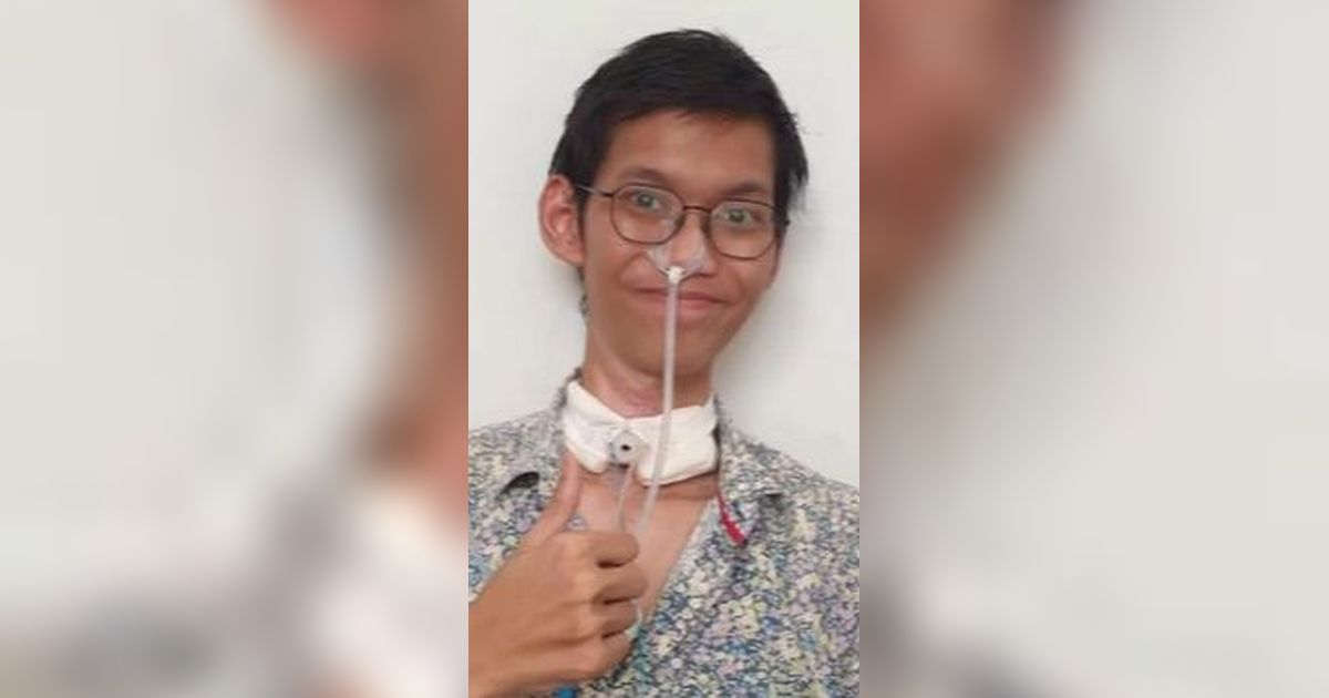 Kondisi Terkini Sultan Rifat, Mahasiswa Terjerat Kabel Optik di Jaksel