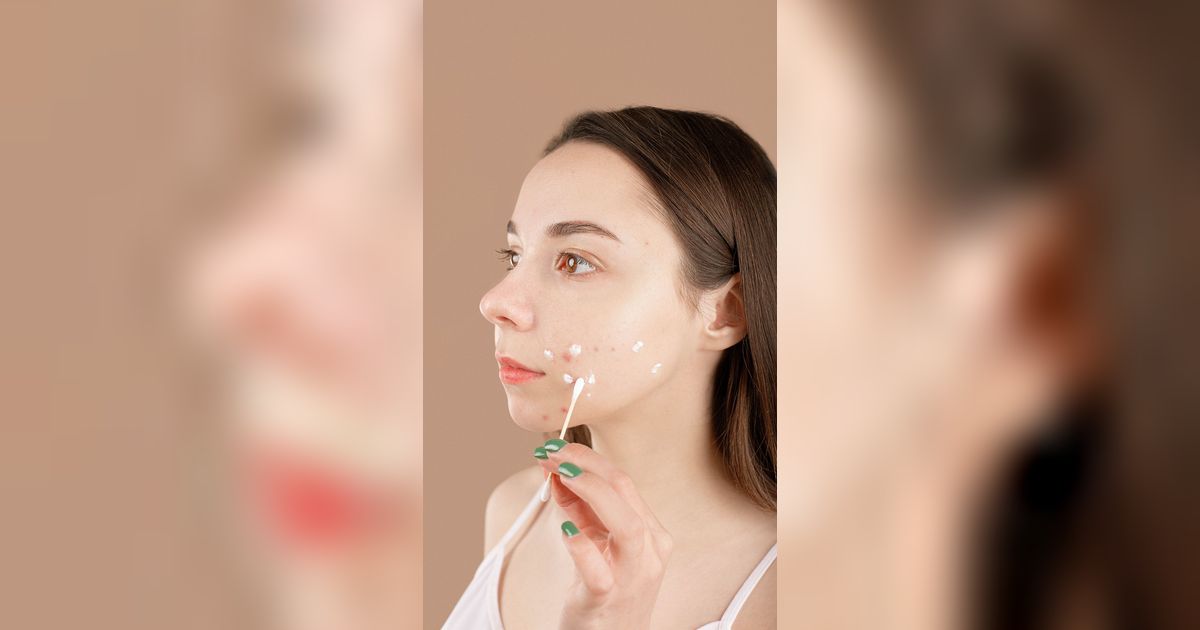 15 Rekomendasi Obat Luka Biar Cepat Kering, Mulai Luka Bakar hingga Sayatan