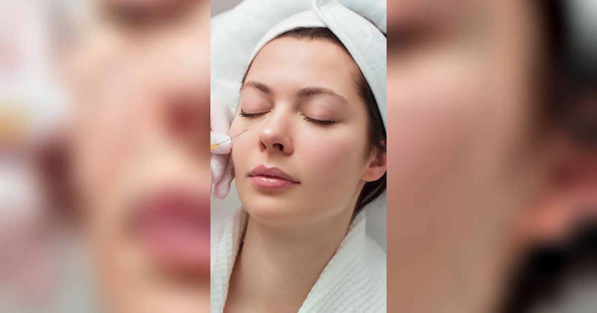 Mengenal Treatment Collagen Stimulator yang Bikin Kulit Awet Muda