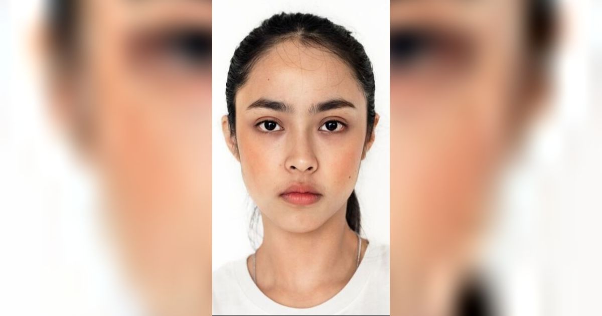 Wajah Tidak Simetris? Temukan Penyebabnya dan Solusinya