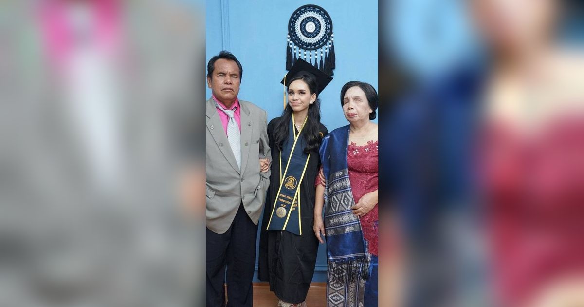 Kisah Septiani Hirawati jadi Mahasiswi Terbaik Lulus Cumlaude, Ibu Bapaknya Tunanetra Hadiri Wisuda Begitu Bangga