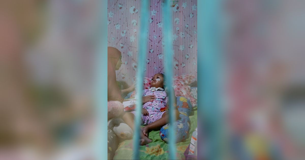 FOTO: Kisah Penderitaan Anak-Anak Gagal Ginjal Akut di Indonesia Berjuang Hidup Setelah Keracunan Obat Sirup