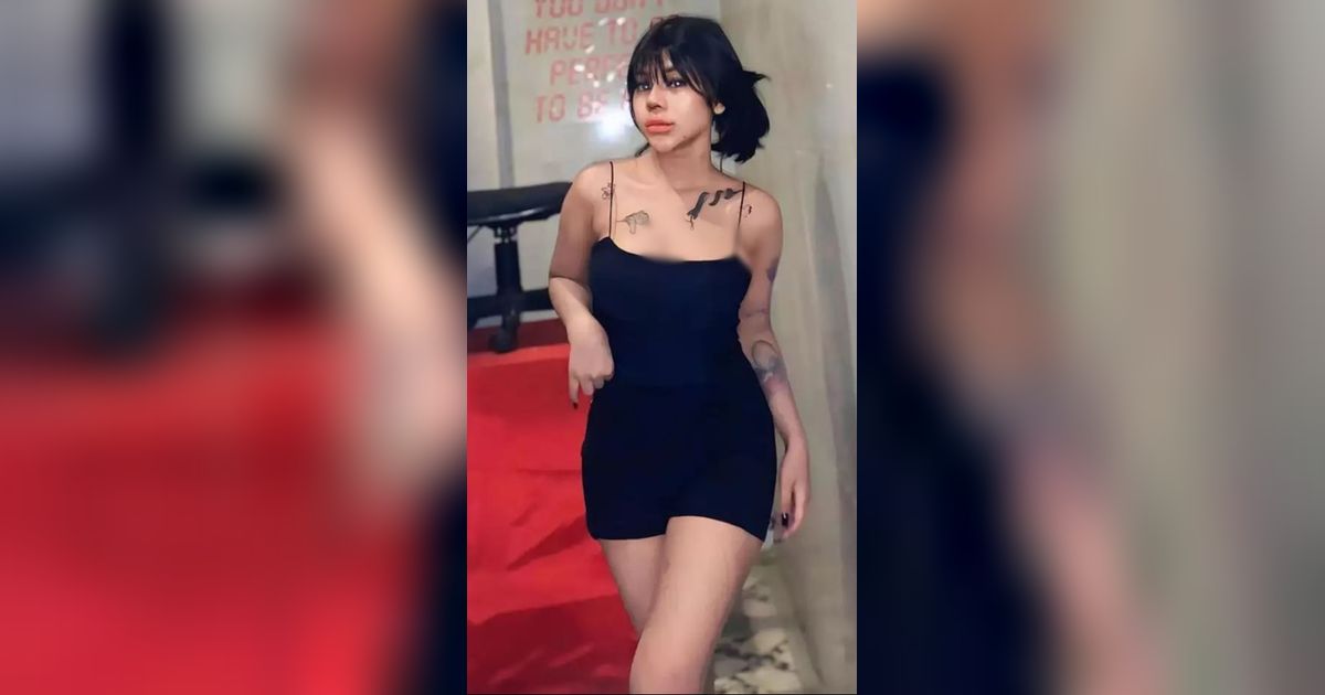 9 Potret Cimoy Montok Usai Oplas Hidung, Disebut Makin Cantik & Mirip Ivan Gunawan