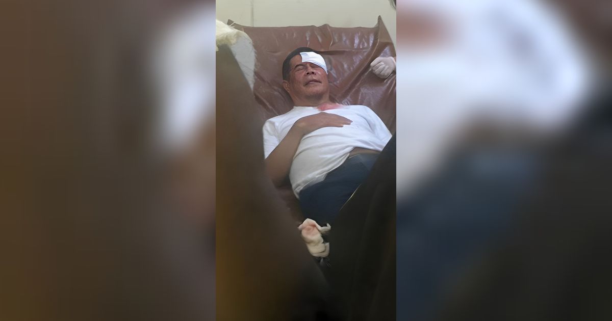 Iring-iringan Jenazah Lukas Enembe Ricuh, Pelipis Pj Gubernur Papua Berdarah Terkena Lemparan Batu